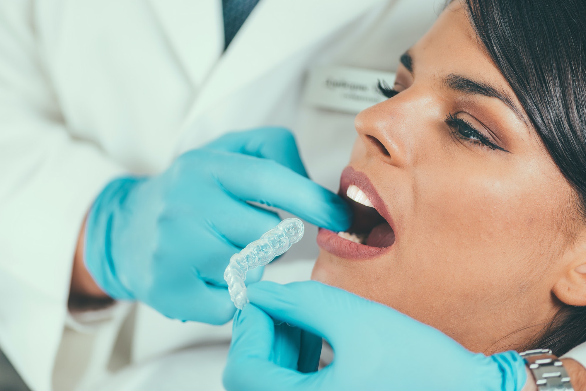 Tooth whitening procedure